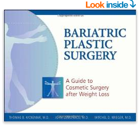 Dr. Lomonaco Bariatric Plastic Surgery Book