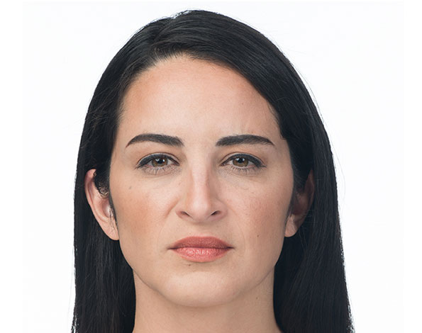 Botox after